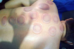 bio-massage-balinese-18